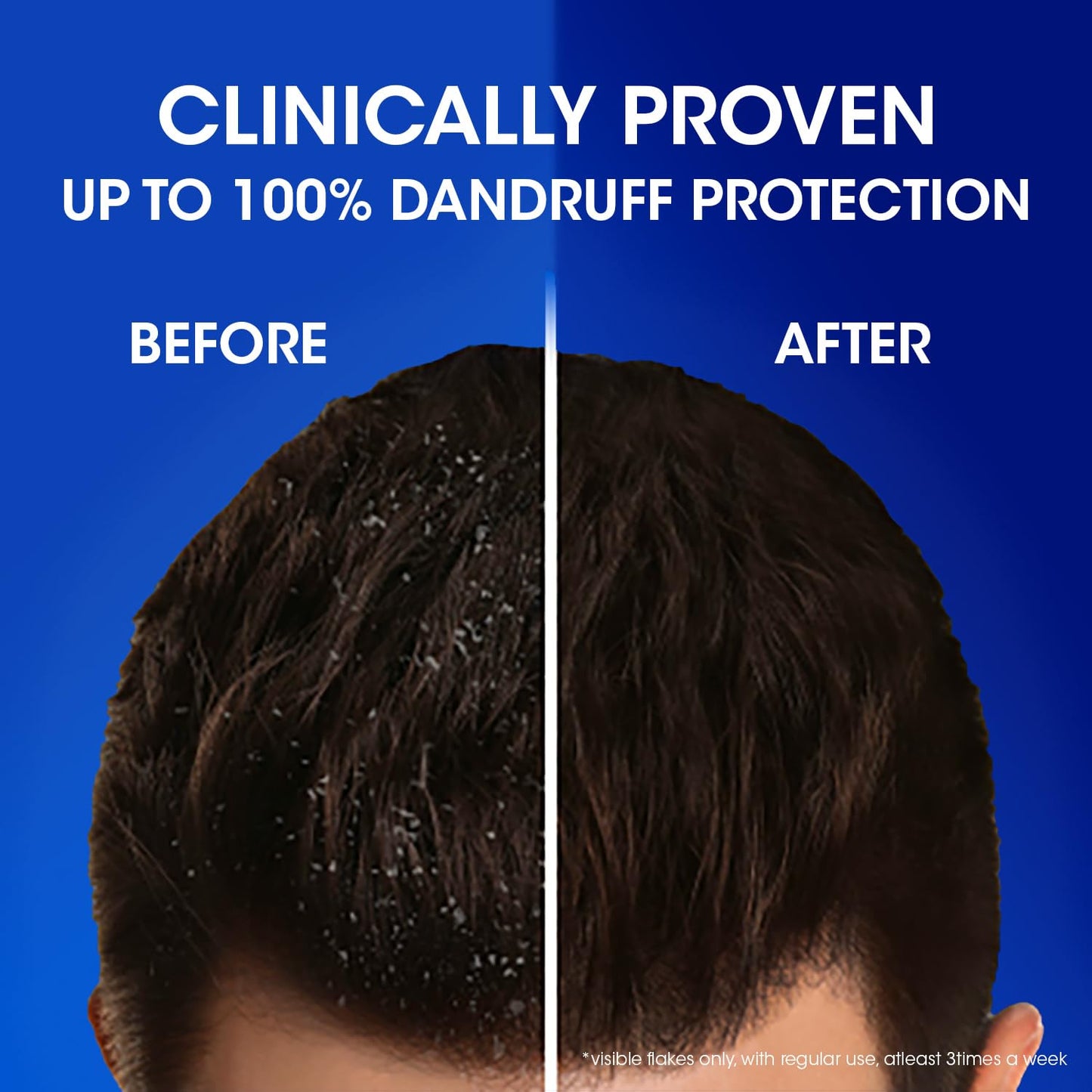 Head & Shoulders - Cool Menthol - Anti-Dandruff Shampoo for Itchy Scalp - 300 ml